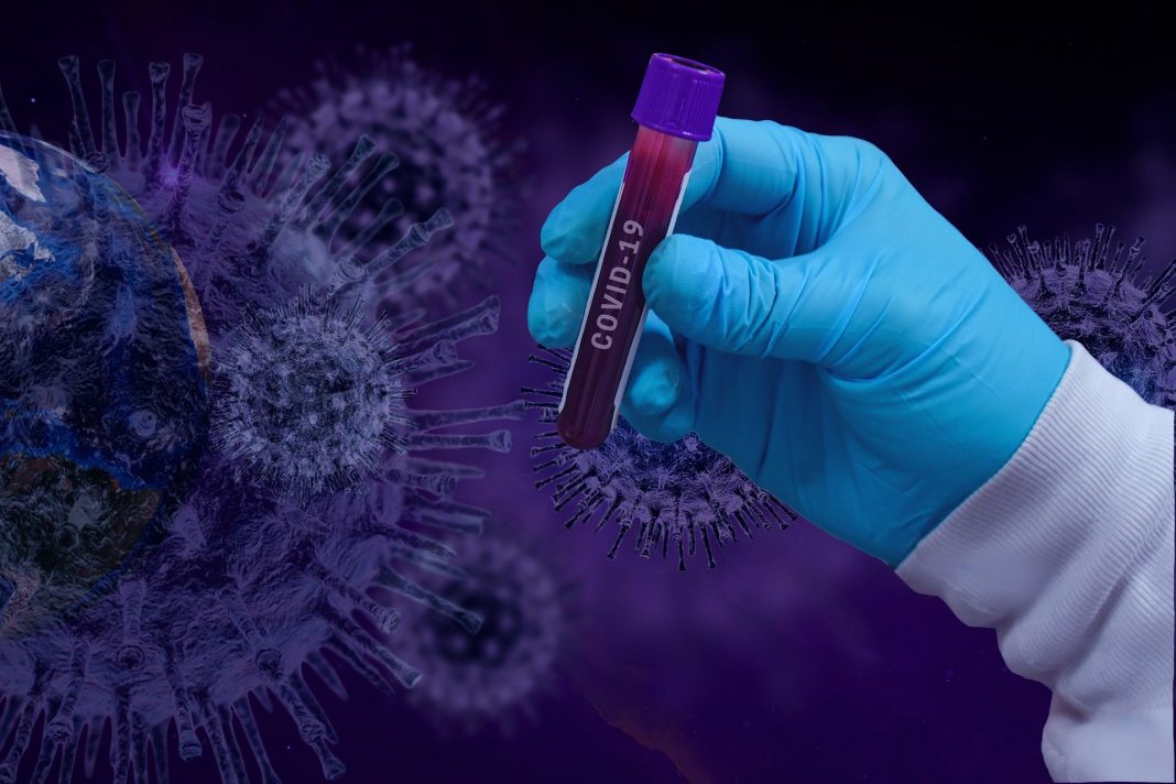 Epidemija