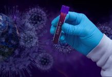 Epidemija